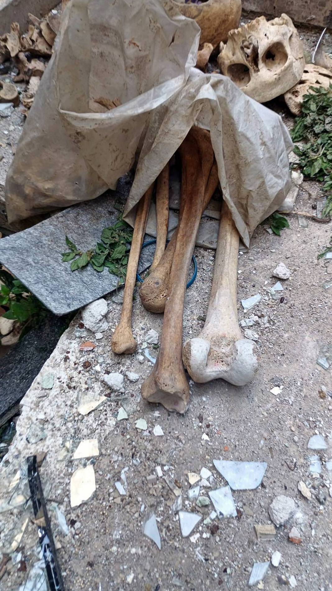 Metruk binada hurda ararken insan iskeleti buldular! Eski doktorun evindeki ürkütücü keşif 4